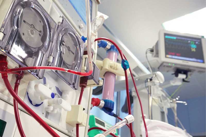 Reverse osmosis (RO)